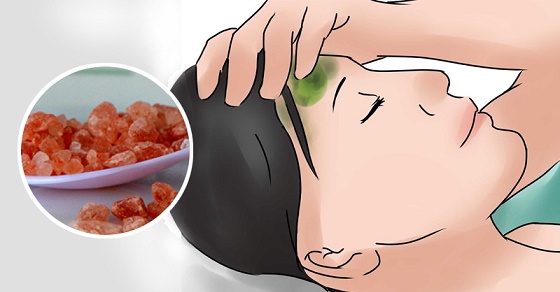How To Stop A Migraine In Seconds With One 100% Natural Ingredient